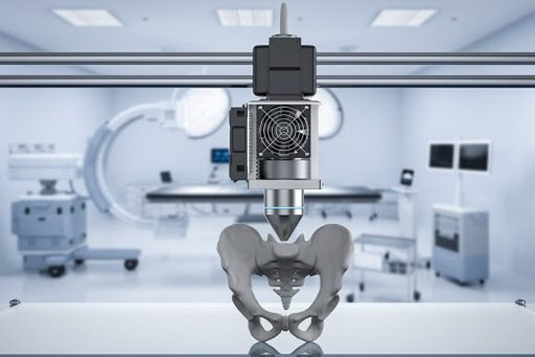 3D printing in medicine