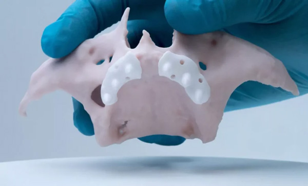 3D Printing in medicine Services