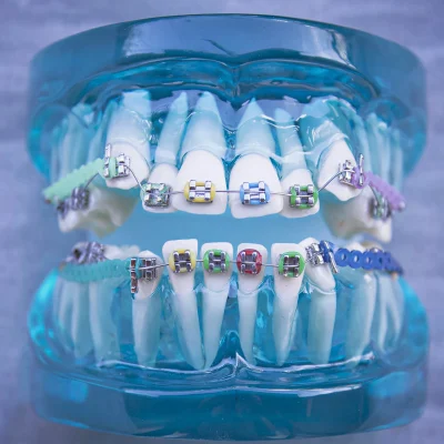 dental-orthodontics dental-orthodontics